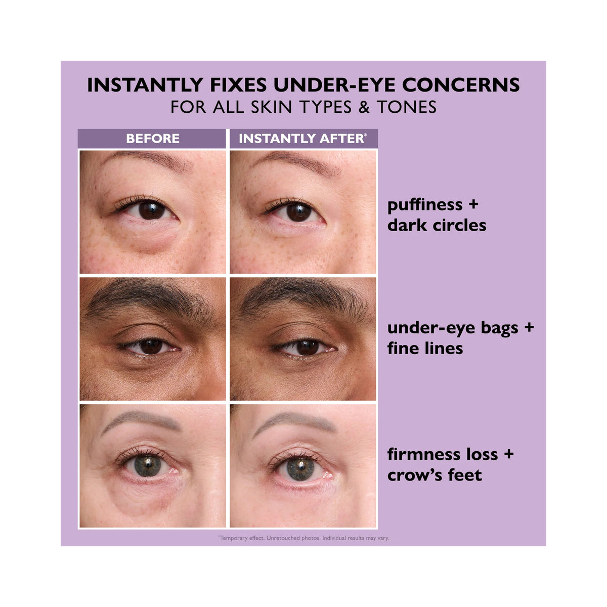 Peter_Thomas_Roth_Instant_FirmX_Eye_Easy-Wear_Formula_20ML / 20ML, image 32906873864342