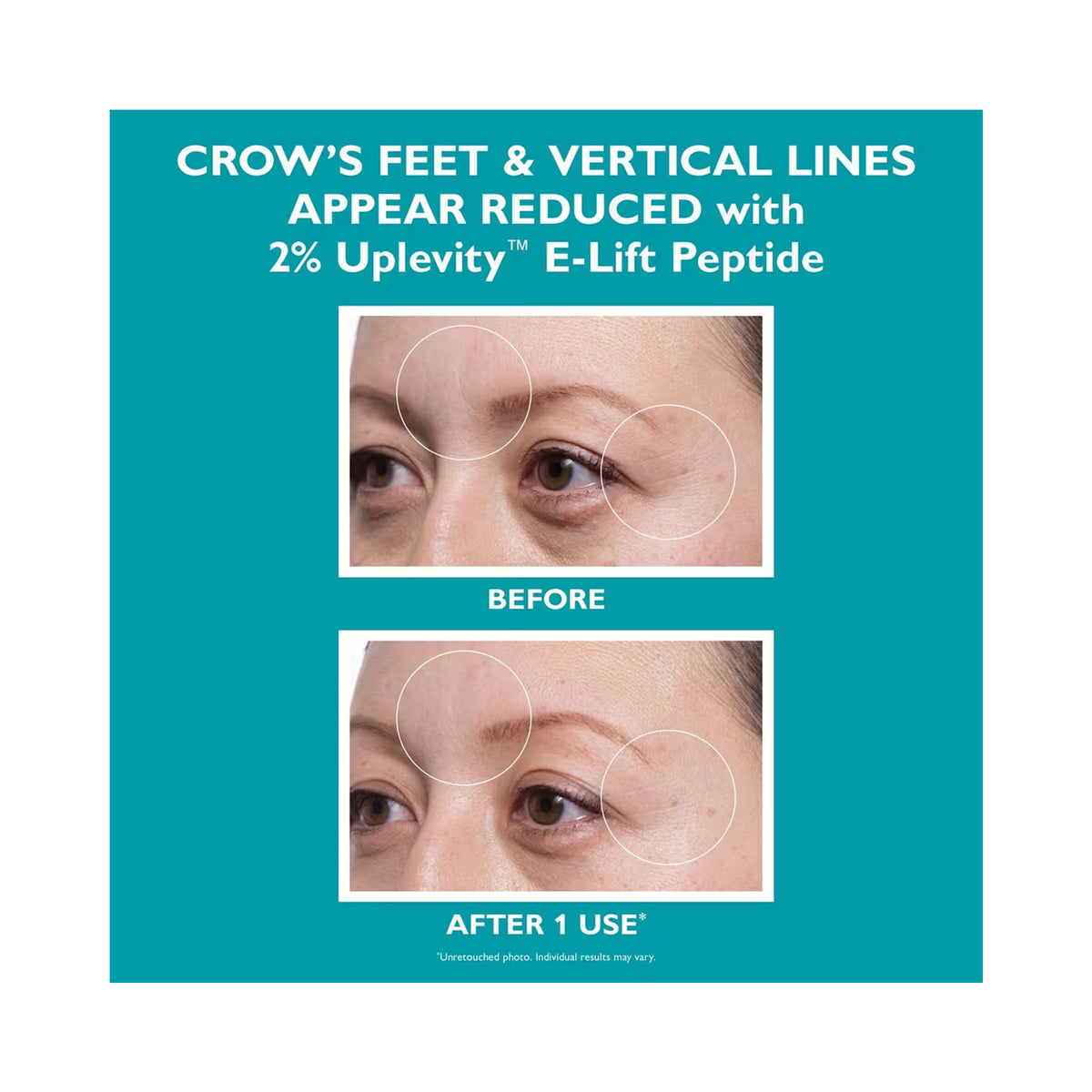 Peter Thomas Roth Peptide Skinjection Expression Line Hydra-Gel Patches