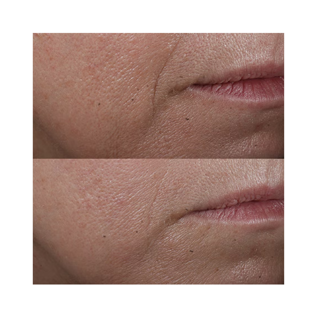 Perricone_MD_Cold_Plasma_Plus_Advanced_Serum_Concentrate_1OZ / 1OZ, image 30650010075286