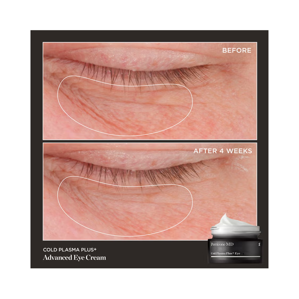Perricone_MD_Cold_Plasma_Plus_Advanced_Eye_Cream_.5OZ / .5OZ thumbnail 4