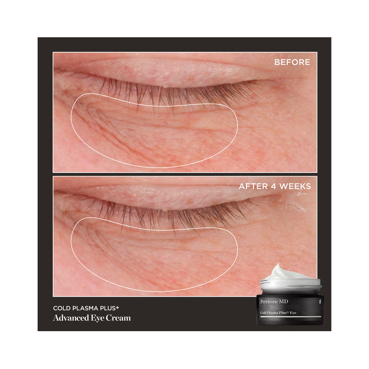 Perricone_MD_Cold_Plasma_Plus_Advanced_Eye_Cream_.5OZ / .5OZ, image 30649986810006