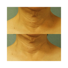 Perricone_MD_Cold_Plasma_Plus_Neck_Chest_Broad_Spectrum_SPF_25_1OZ / 1OZ