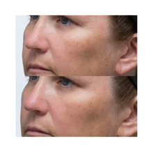 Perricone_MD_High_Potency_Classics_Hyaluronic_Intensive_Moisturizer_1OZ / 1OZ