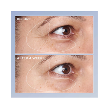 Perricone_MD_High_Potency_Triple_Retinol_Renewal_Eye_Serum_0.5OZ / 0.5OZ