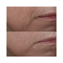 Perricone_MD_Cold_Plasma_Plus_Advanced_Serum_Concentrate_2OZ / 2OZ