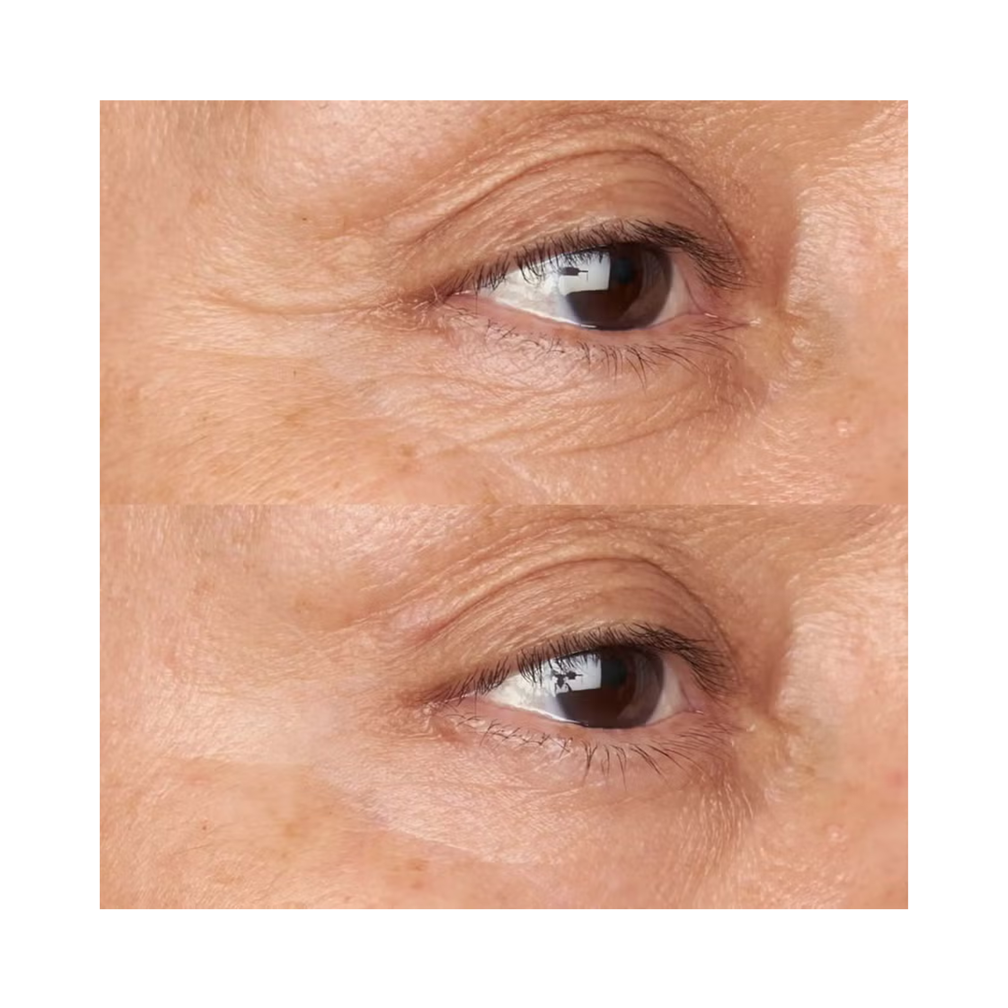 Perricone MD Hypoallergenic Clean Correction Firming & Brightening Eye Cream 0.5OZ / 0.5OZ