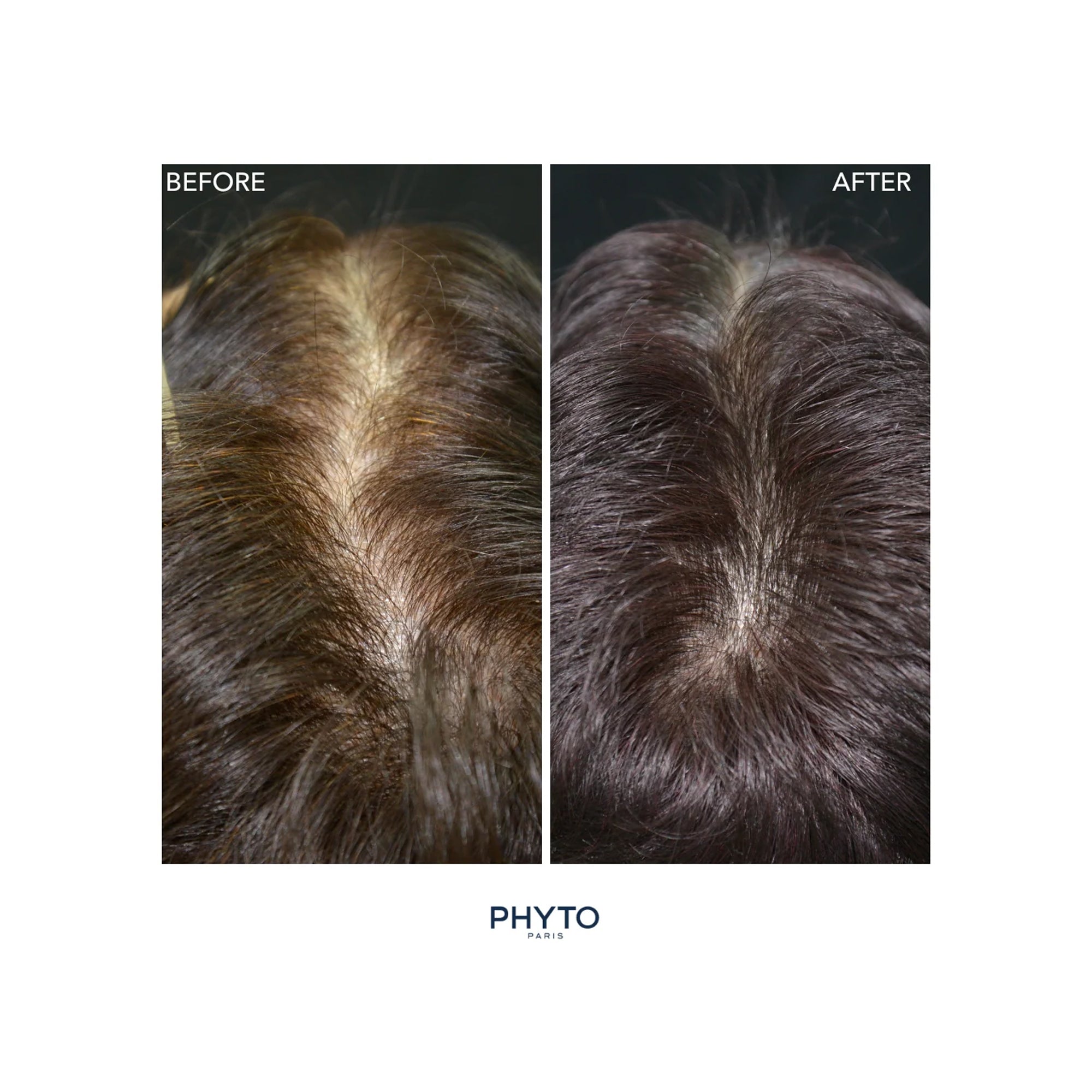 Phyto PhytoCyane Anti-Hair Thinning Dietary Supplement (12 Week Supply) / 84 Capsules
