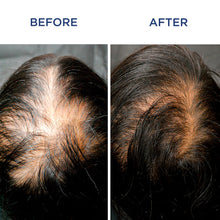 Phytocyane Women Treatment Progressive Hair Thinning -12 Vials / 0.16 oz