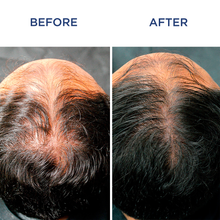 Phytocyane Men Treatment Progressive Hair Thinning - 12 Vials / 0.12 oz