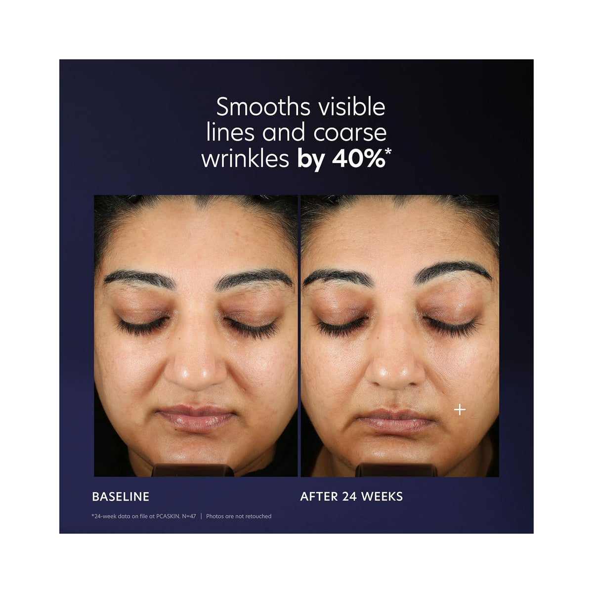 PCA Pro-Max Age Renewal / 1OZ, image 46220595429526