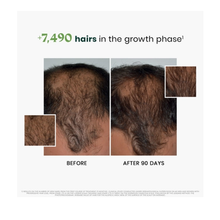 Rene_Furterer_Progressive_Thinning_Hair_Kit / KIT