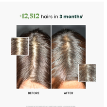 Rene_Furterer_Reactional_Thinning-Hair_Kit / KIT