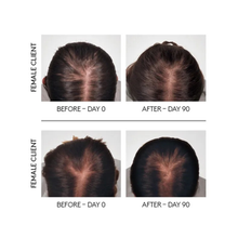 Rene Furterer TRIPHASIC Reactional Concentrated Serum - 12 Vials / 0.16