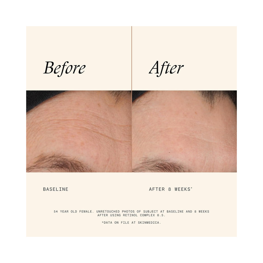 SkinMedica Retinol Complex 0.5 / 1OZ thumbnail 5