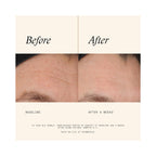 SkinMedica Retinol Complex 0.5 / 1OZ