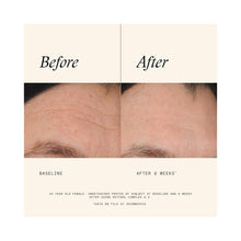 SkinMedica Retinol Complex 0.5 / 1OZ