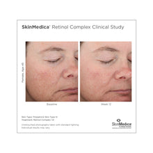 SkinMedica Retinol Complex 1.0 / 1OZ