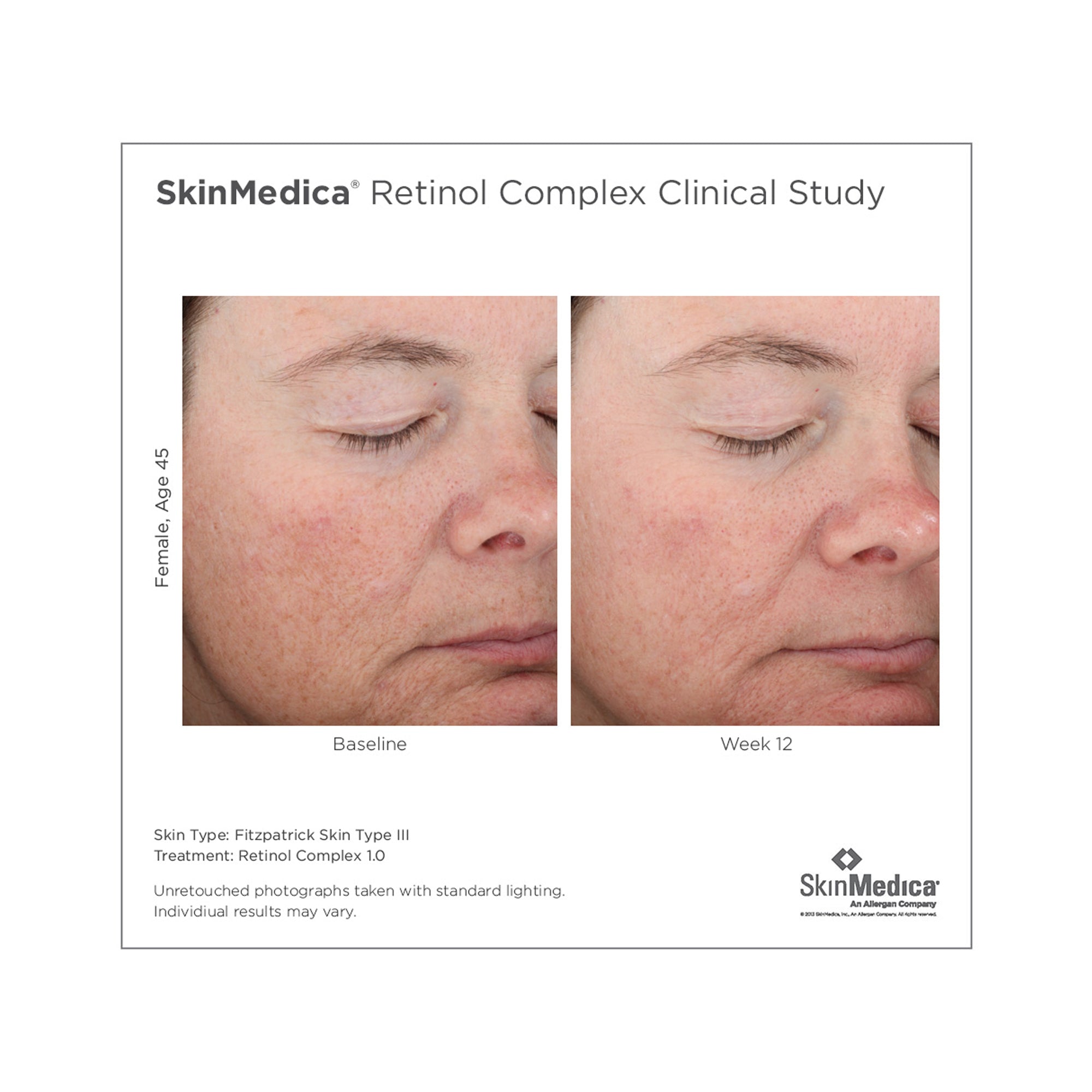 SkinMedica Retinol Complex 1.0 / 1OZ