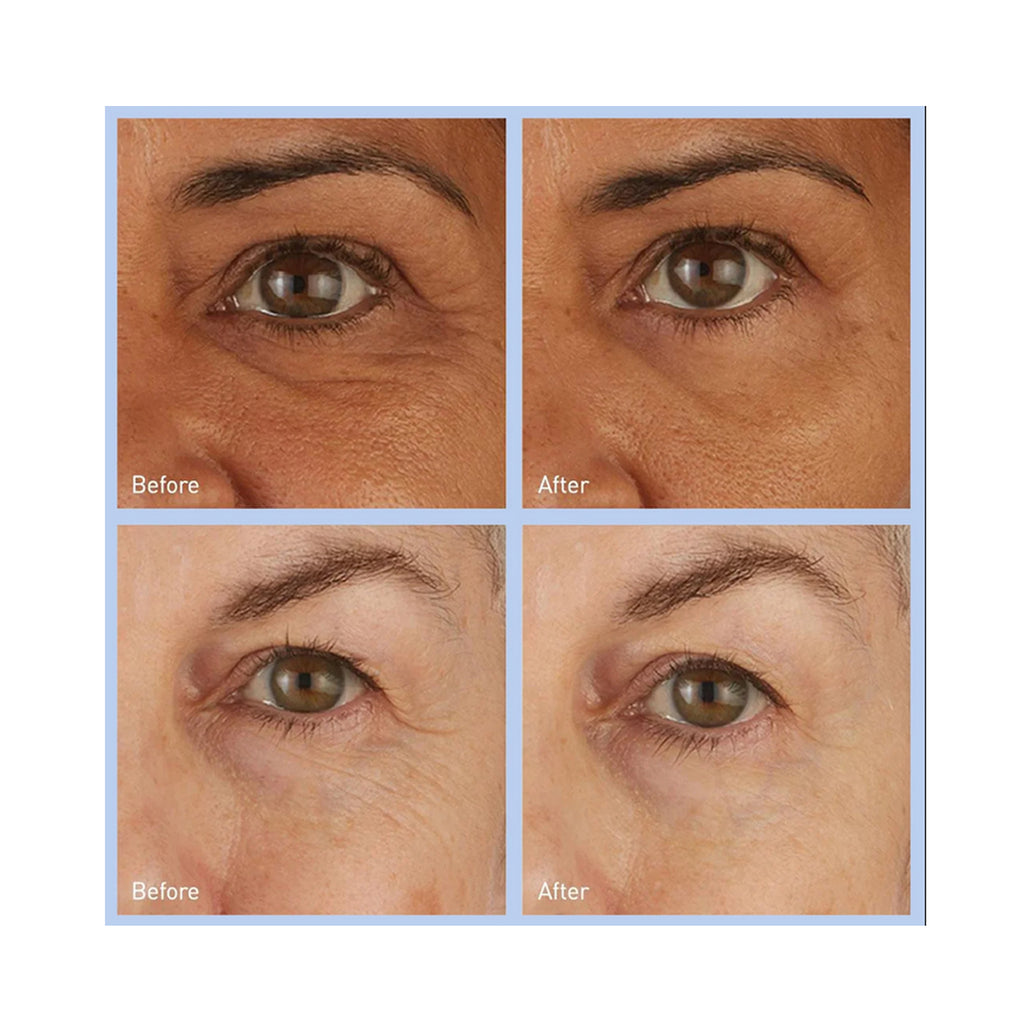Skyn Iceland Hydro Cool Firming Eye Gel 8 pair