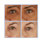 Skyn Iceland Hydro Cool Firming Eye Gel 8 pair
