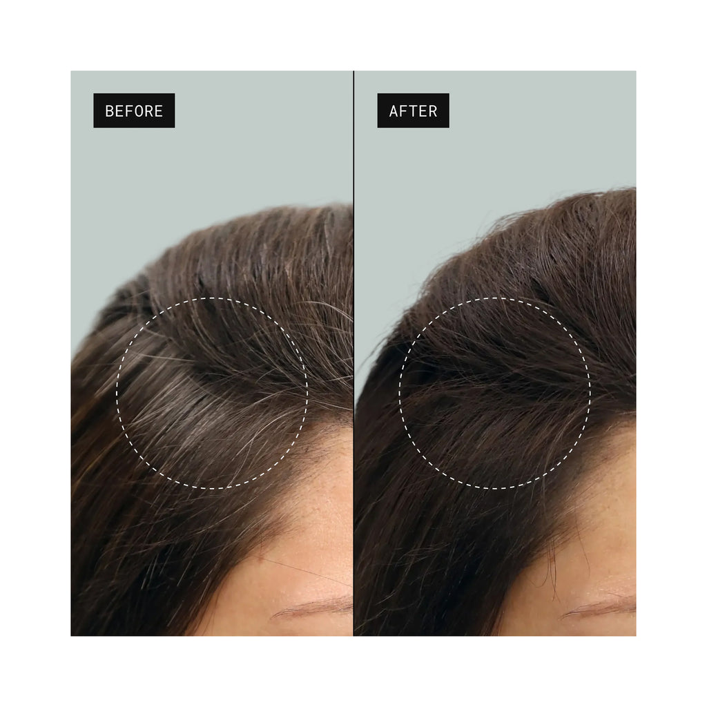 Toppik 3-In-1 Colored Hair Thickener Spray - Medium Brown 5.1oz / MEDIUM BROWN thumbnail 5