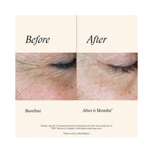 SkinMedica TNS Recovery Complex / 1OZ