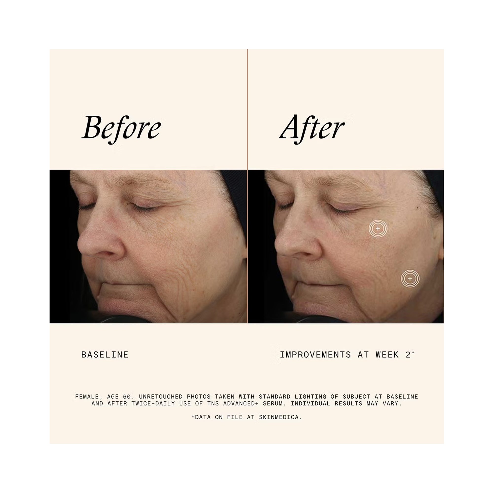 SkinMedica TNS Advanced + Serum / 1OZ