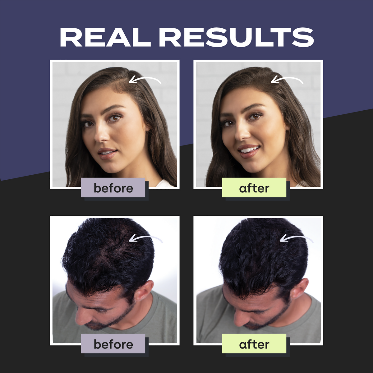 Toppik Hair Building Fibers Black, image 27578542063766