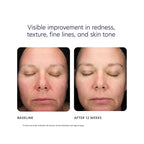 PCA Triple Exfoliation Peel Pads / 30CT