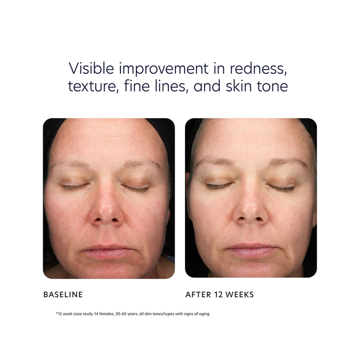 PCA Triple Exfoliation Peel Pads / 30CT, image 46220636225686
