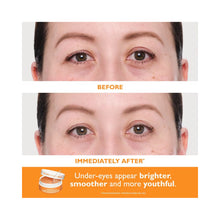 Peter Thomas Roth Full-Size Vitamin C & Hyaluronic Eye Patches 2-Piece Gift Set