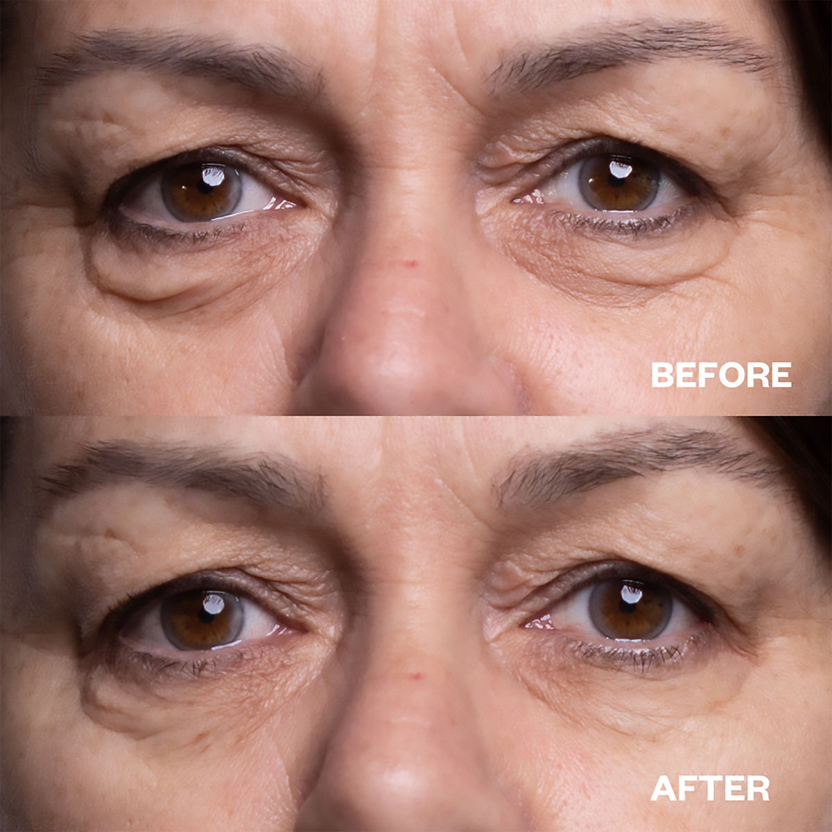 Wrinkles Schminkles Eye Wrinkle Patches - 3pk, image 27392258146454