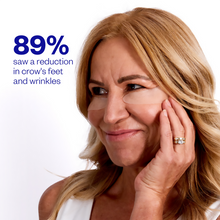 Wrinkles Schminkles Eye Wrinkle Patches - 3pk