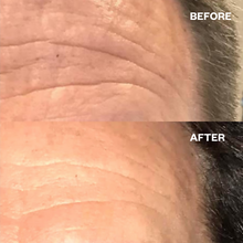 Wrinkles Schminkles Forehead Wrinkle Patches - 2pk