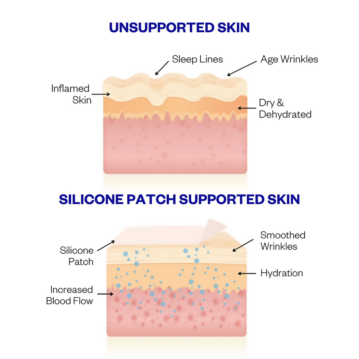 Wrinkles Schminkles Forehead Wrinkle Patches - 2pk, image 27415797956758