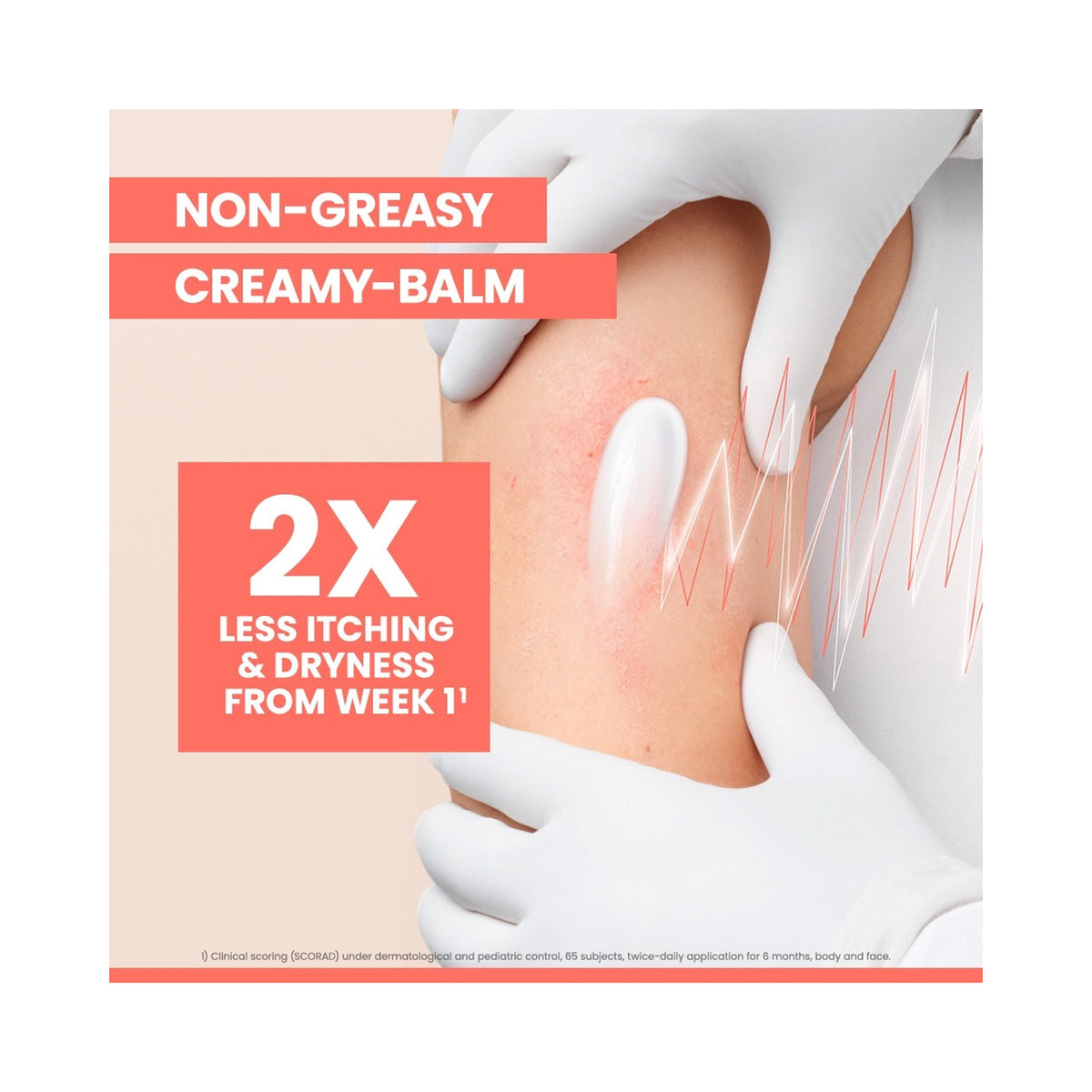 A promotional graphic for a non-greasy, creamy balm showing a close-up of a person's skin with white balm applied text overlays reading 'NON-GREASY CREAMY-BALM' and '2X LESS ITCHING & DRYNESS FROM WEEK 1'., image 46243858022550