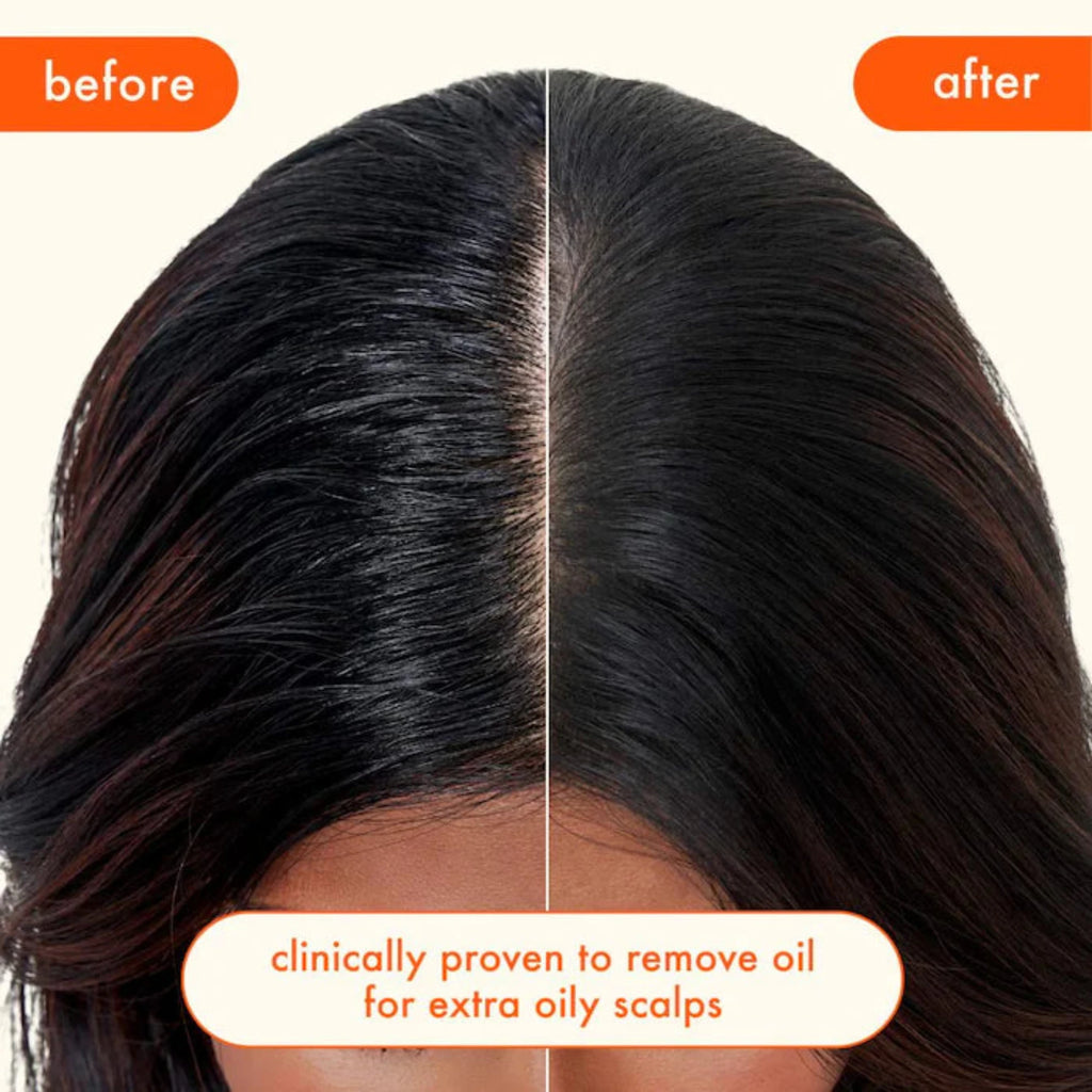 Amika Perk Up Ultra Oil Control Dry Shampoo / 9.5OZ