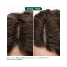 Biolage_Scalp_Sync_Anti_Dandruff_Shampoo_13.5oz_Scalp_Sync_Universal_Conditioner_8oz_Duo / 13.5oz/8oz