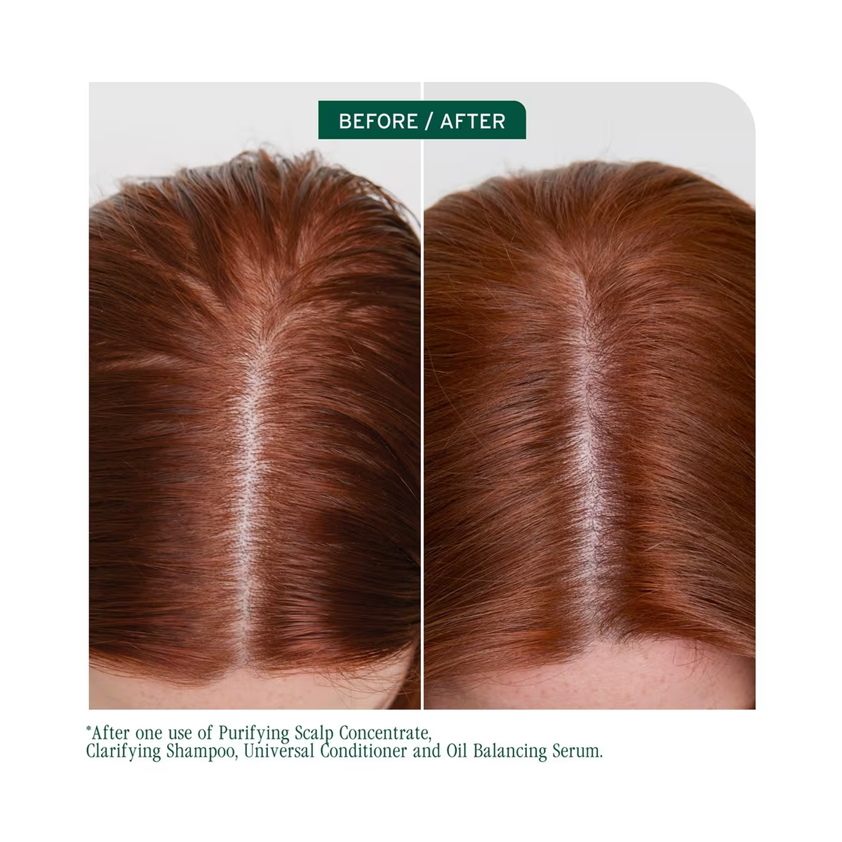 Biolage_Scalp_Sync_Clarifying_Shampoo / 33OZ, image 29946720747670