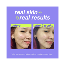 Dermalogica_Clear_Start_Breakout_Clearing_Booster_1oz / 1.OZ