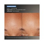 Dermalogica_Daily_Microfoliant_2.6oz / 2.6