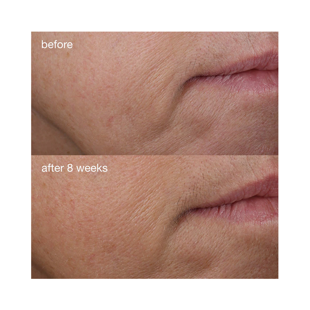 Dermalogica_Phyto_Nature_Firming_Serum_1.3oz / 1.3OZ thumbnail 3