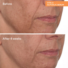 Murad Brighten and Even Tone with Vitamin C kit / KIT