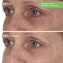 Murad Resurgence Retinol Youth Renewal Serum / 1 OZ