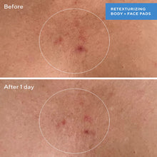 Murad Retexturizing Body Pads / 45PK