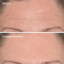 Murad Targeted Wrinkle Corrector / .5OZ