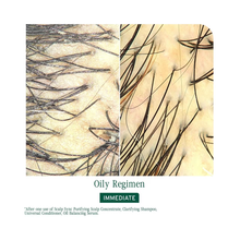 Biolage_Scalp_Sync_Oil_Balancing_Serum / 1.6OZ