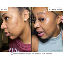 reVive Lux Spot Acne Treatment Device / BLACK