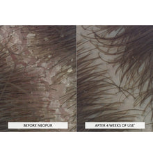 Rene Futerer NEOPUR Balancing Shampoo Oily / 5OZ