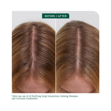 Biolage_Scalp_Sync_Calming_Shampoo_Scalp_Sync_Universal_Conditioner_Liter_Duo / 33OZ